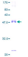 Human AMACR / P504S Protein (Recombinant GST)