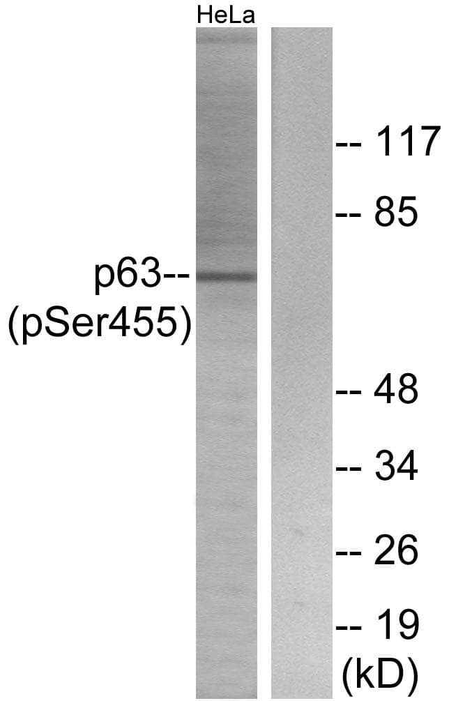 Polyclonal Rabbit anti-Human TP63 / p63 Antibody (phospho-Ser455, IHC, WB)