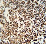 Polyclonal Rabbit anti-Human GTSF1 Antibody (aa37-66, IHC, WB)