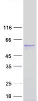 Human TSTD2 Protein (Recombinant Myc-DDK (Flag))