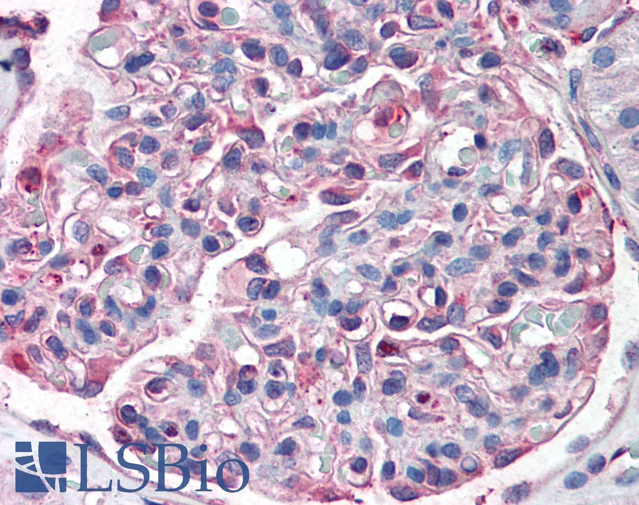 IHC-plus™ Polyclonal Rabbit anti-Human SLC39A14 / ZIP14 Antibody (Internal, IHC)