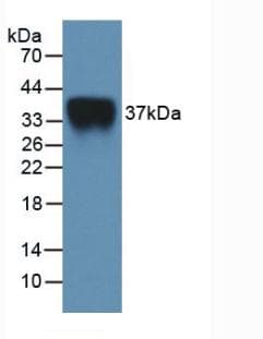 Mouse IL2RA / CD25 Protein (Recombinant His, N-Terminal)