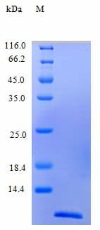 Human CCL26 / Eotaxin 3 Protein (Recombinant)
