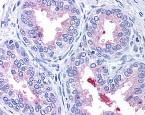 ABCA1 Antibody (Biotin)