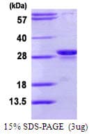Human PSMB10 Protein (Recombinant His)