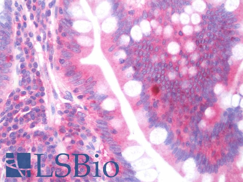 IHC-plus™ Ras-related protein Rab-4 (RAB4) Antibody (clone 4E+11)