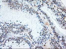 Monoclonal Mouse anti-Human NTF3 / Neurotrophin 3 Antibody (clone OTI5A2, IHC, IF, WB)