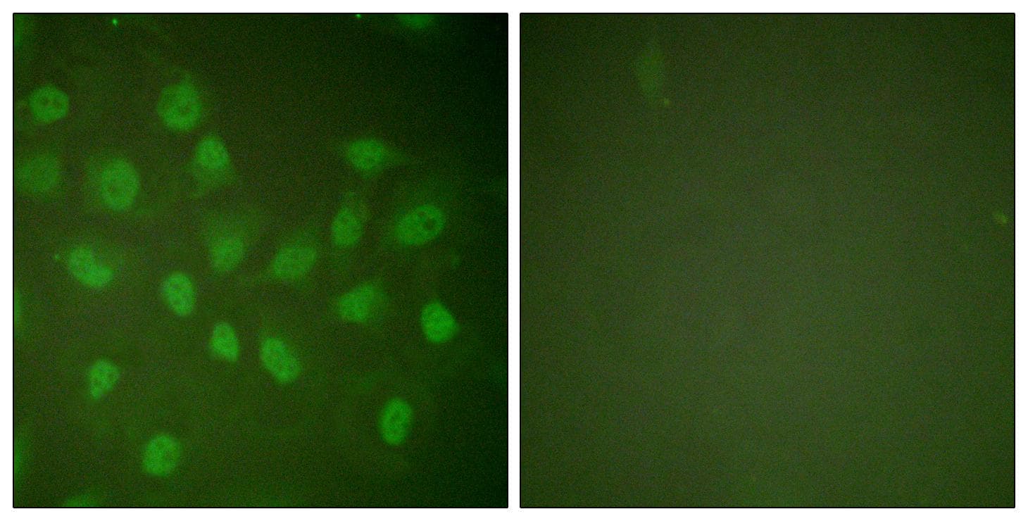POLR2A / RNA polymerase II Antibody (p1619)