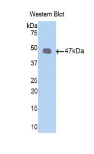 PRDX2 / Peroxiredoxin 2 Antibody (aa6-164)