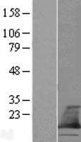 TMEM60 Protein (Over-Expression Lysate Myc-DDK (Flag))