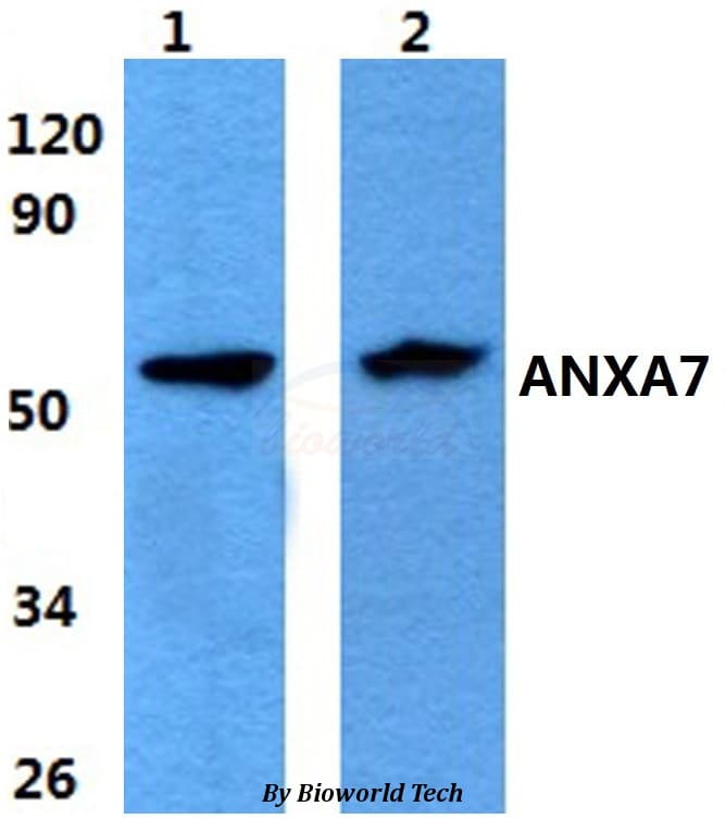 ANXA7 / Annexin VII / SNX Antibody