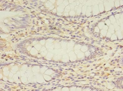 PEX11B Antibody