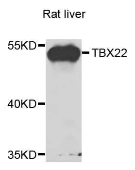 Polyclonal Rabbit anti-Human TBX22 Antibody (IHC, WB)