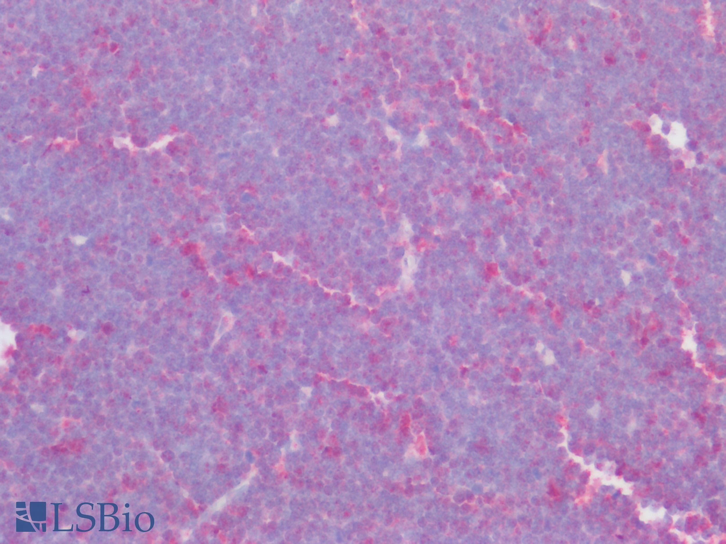 IHC-plus™ Polyclonal Rabbit anti-Human CCR2 Antibody (N-Terminus, IHC)