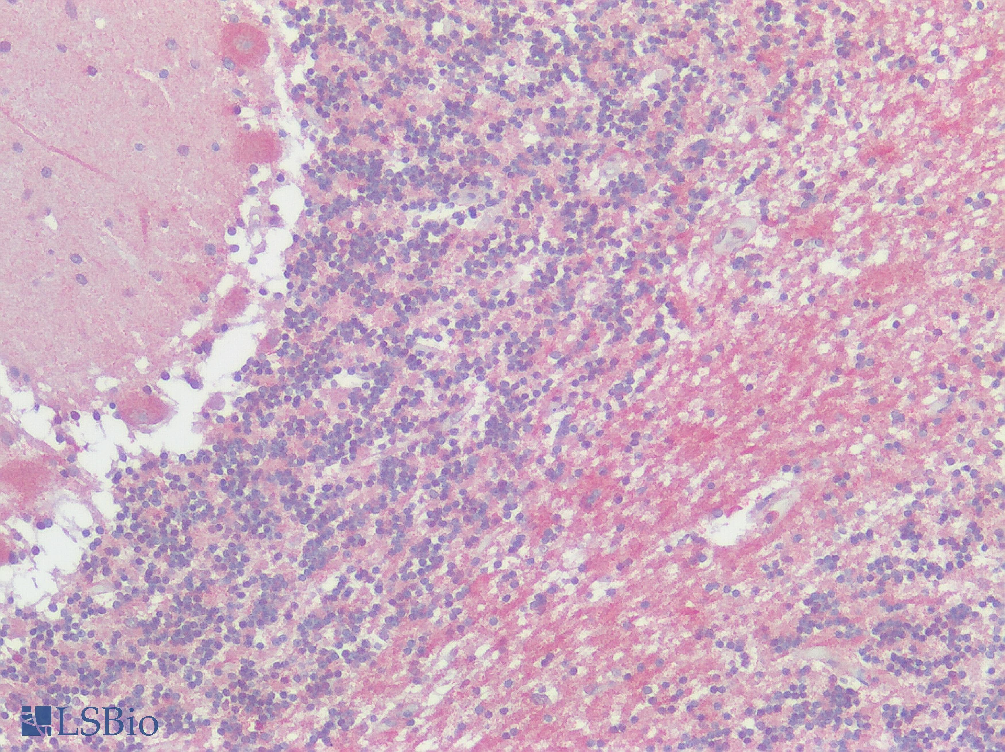 IHC-plus™ ADORA3 / Adenosine A3 Receptor Antibody (Cytoplasmic Domain)
