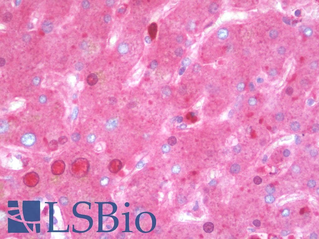 IHC-plus™ SERPINA1 / Alpha 1 Antitrypsin Antibody (clone 5B12)