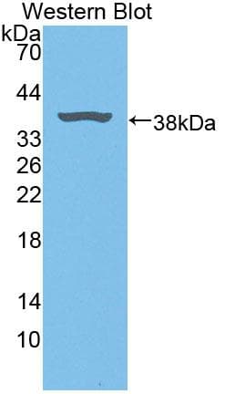 BLVRA Antibody (aa10-279, PE)