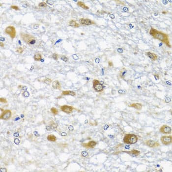Polyclonal Rabbit anti-Human DDX39 Antibody (IHC, WB)