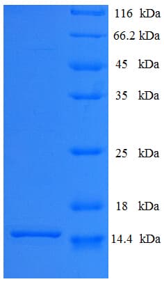 Human SFTA3 Protein (Recombinant His)