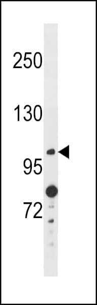 Polyclonal Rabbit anti-Human ANO4 Antibody (aa188-216, WB)