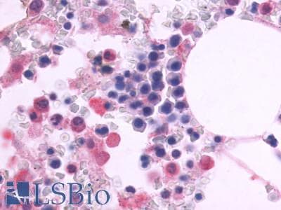 PathPlus™ Polyclonal Rabbit anti-Human ADGRE5 / CD97 Antibody (Cytoplasmic Domain, IHC)