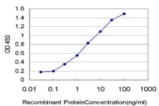 Monoclonal Mouse anti-Human PR / Progesterone Receptor Antibody (clone 2C2, IHC, IF, WB)