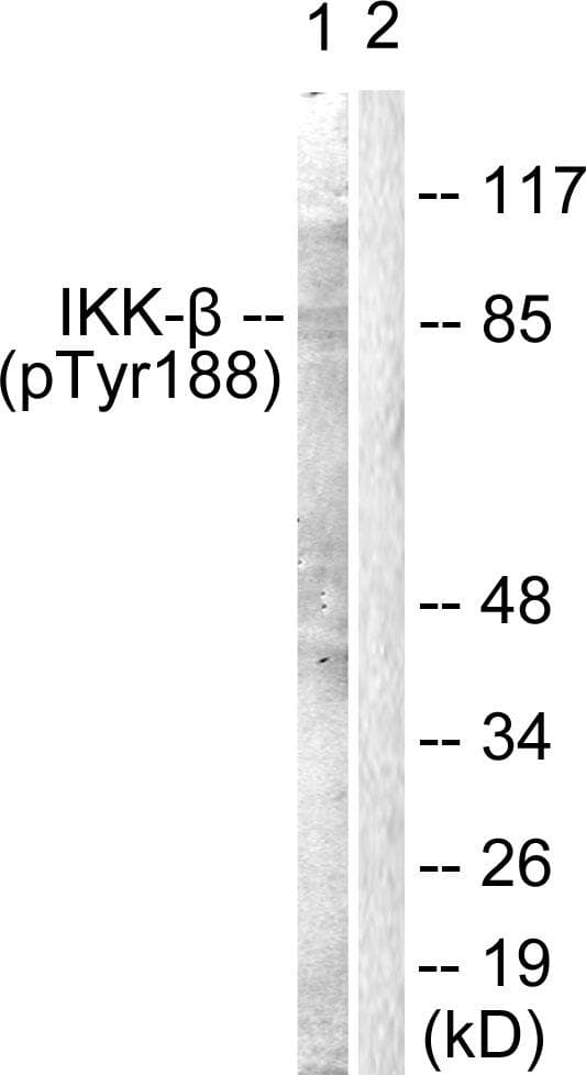 IKBKB / IKK2 / IKK Beta Antibody (phospho-Tyr188)