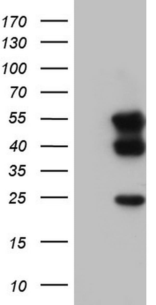 TACC2 Antibody (aa727-1026, clone OTI5H1)