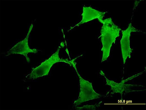 Monoclonal Mouse anti-Human PAK3 Antibody (clone 1H7, IF, WB)