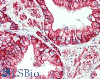 IHC-plus™ CHRM1 / M1 Antibody (270-350 aa, Internal)