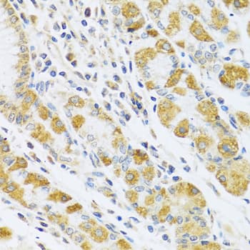 PSG1 / CD66f Antibody