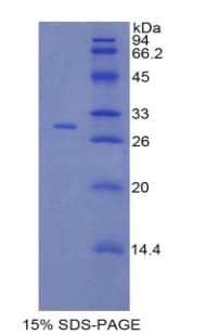 Human F5 / Factor Va Protein (Recombinant His)