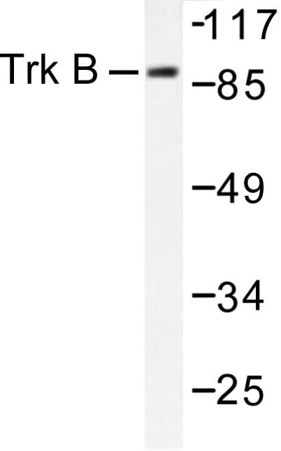 NTRK2 / TRKB Antibody (Val509)