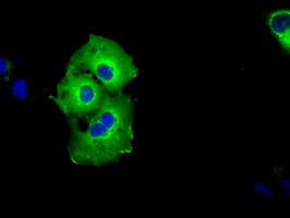 Monoclonal Mouse anti-Human p66 / SHC Antibody (clone OTI1D3, IF, WB)