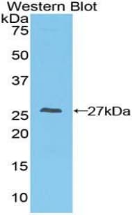 TIGIT Antibody (aa21-234, FITC)