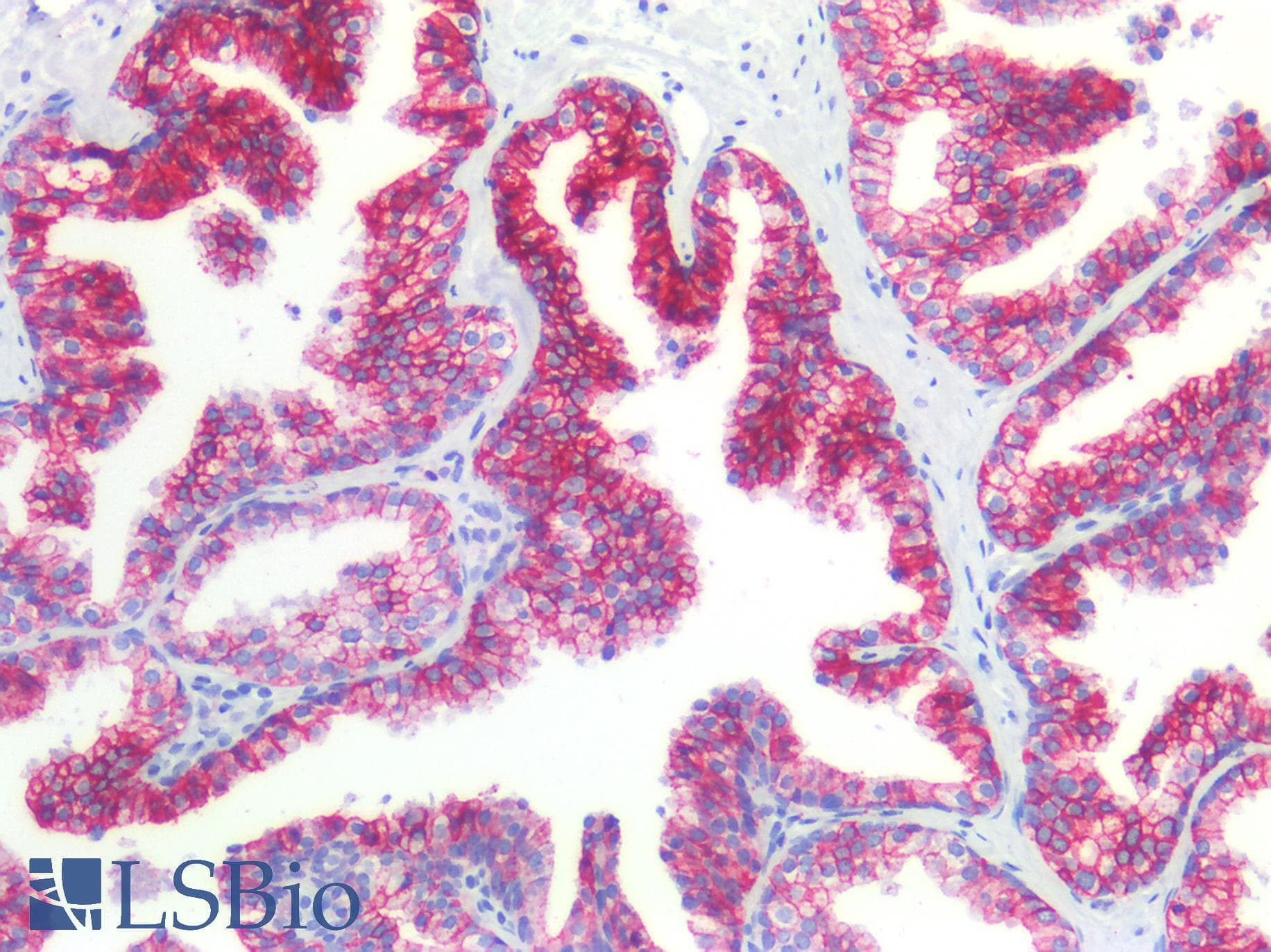 PathPlus™ CLDN3 / Claudin 3 Antibody (140-220 aa, C-terminal)