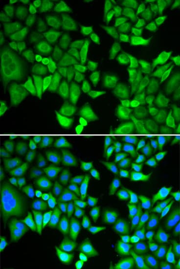 IHC-plus™ KPNA2 / Importin Alpha 1 Antibody