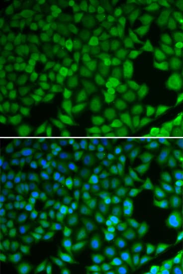 PathPlus™ NDRG1 Antibody