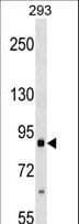 ITGB2 / CD18 Antibody