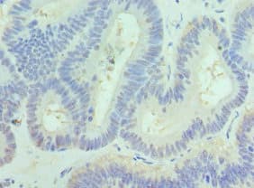 Polyclonal Rabbit anti-Human PAK1 Antibody (aa1-240, IHC)