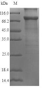 Human AKAP82 / AKAP4 Protein (Recombinant 6His, N-terminus)