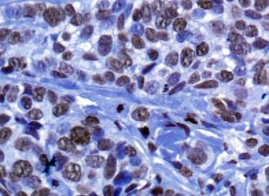 Histone H3 Antibody (aa100-150)