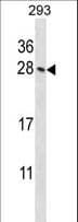 Polyclonal Rabbit anti-Mouse HOXB4 Antibody (aa7-35, WB)