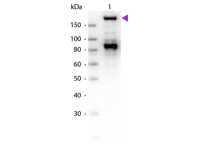 A2M / Alpha-2-Macroglobulin Antibody (Lyophilized)