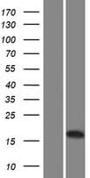 LCNL1 Protein (Over-Expression Lysate Myc-DDK (Flag))