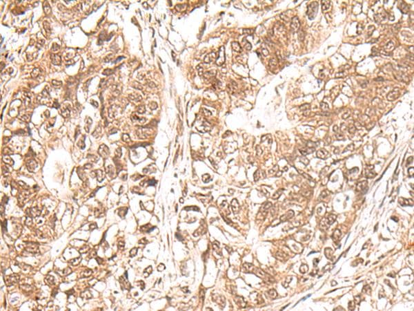 Polyclonal Rabbit anti-Human USP16 Antibody (IHC)