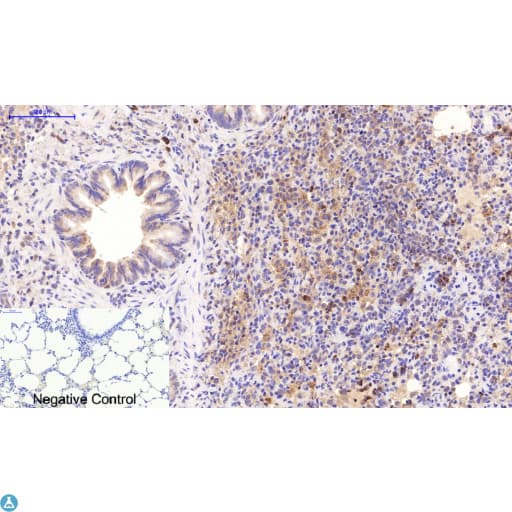 TUBE1 / Tubulin Epsilon Antibody