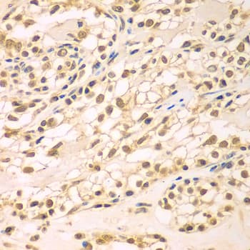 TBL1XR1 / TBLR1 Antibody