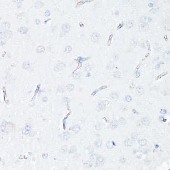 Polyclonal Rabbit anti-Human ABCB1 / MDR1 / P Glycoprotein Antibody (IHC, WB)