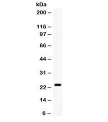 FGF1 / Acidic FGF Antibody